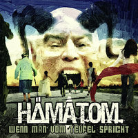 Totgesagt doch Neugeboren - Hämatom