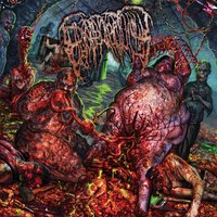 Gobbling the Erupted Intestinal Mash - Epicardiectomy