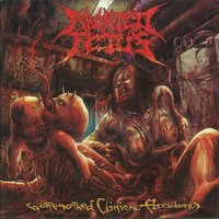 Autofagus - Aborted Fetus