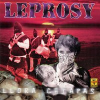 Monumento a los Caídos - Leprosy