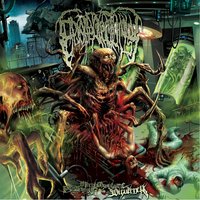 Deformed to Shapeless Cadaver - Epicardiectomy