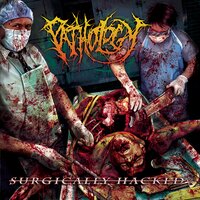 Surgically Dismembered - Pathology
