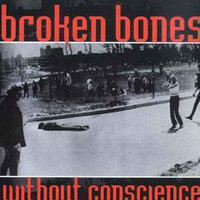 8 Second Seizure - Broken Bones