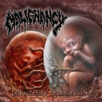 Bag - Malignancy